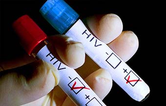Ambulatório da UEM aplica teste para HIV no período da manhã desta quinta-feira (26) 