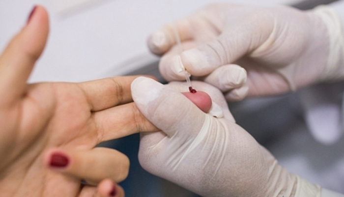 Teste rápido para HIV/Aids será feito, gratuitamente, na sexta-feira (7)
