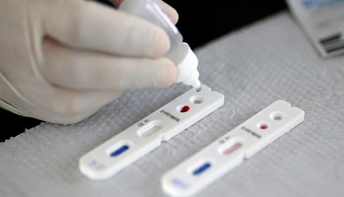 Pesquisadores de São Paulo desenvolvem testes rápidos para detectar coronavírus