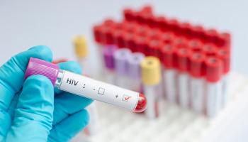 Brasil mais do que dobra o tempo de sobrevida de pessoas com aids 