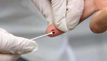 Testes para hepatite C serão feitos de graça em Maringá 