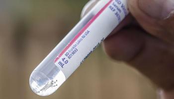Com mais 104 casos, índice de dengue no estado aumenta 11,24% na última semana Com mais 104 casos, índice de dengue no estado aumenta 11,24% na última semana
