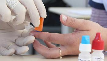 No Brasil, mais de 135 mil pessoas possuem HIV e não sabem No Brasil, mais de 135 mil pessoas possuem HIV e não sabem