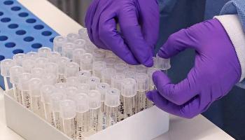 Saiba tudo sobre o Covid-19 e como se proteger do novo vírus Saiba tudo sobre o Covid-19 e como se proteger do novo vírus