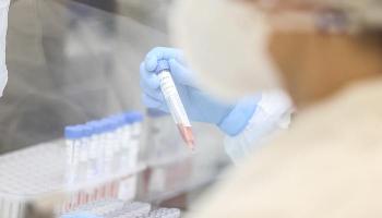 Pessoas entre 20 e 59 anos totalizam 75% dos casos confirmados de Covid-19 