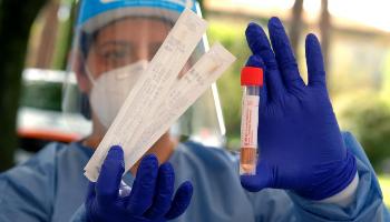 Pesquisadores descobrem que tipo sanguíneo e genes estão ligados à sintomas graves da infecção 