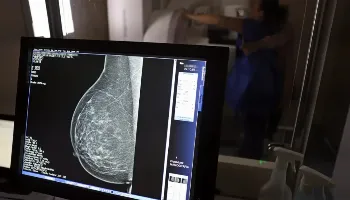 Uma em cada três mulheres com câncer de mama tem menos de 50 anos