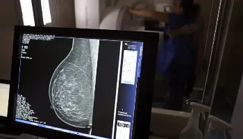 Mais de 77 mil mulheres estão na fila de espera por mamografia realizada pelo SUS 