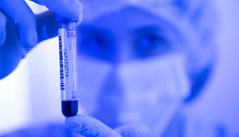 UEM compõe rede paranaense em projeto inédito sobre Coronavirus 