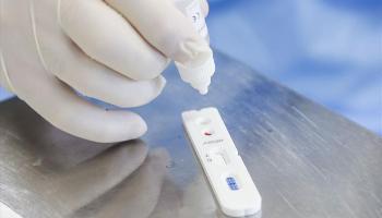 Testes de Covid-19 serão obrigatórios em planos de saúde 