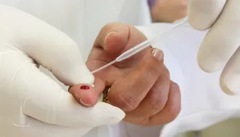 Centro de Testagem de Maringá registra queda no número de novos casos de HIV 