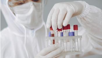 UEM terá único laboratório do interior do Paraná para estudo de vacinas virais 