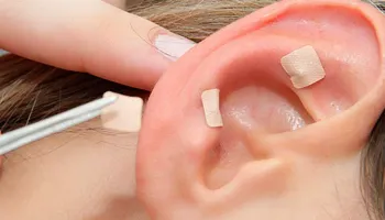 Unidades Básicas de Saúde passam a oferecer auriculoterapia; conheça o tratamento 