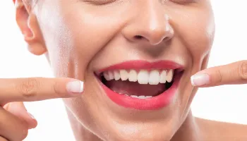 5 mitos e verdades sobre o clareamento dental 