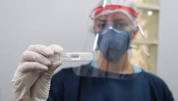 Ministério da Saúde envia 786,5 mil testes rápidos para diagnóstico da covid-19 