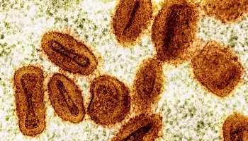 Número de casos de mpox no Brasil neste ano já superou o total de 2023 