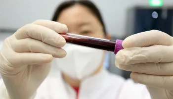 Secretaria de Saúde alerta sobre cuidados e prevenção da sífilis 