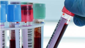 Pandemia pode colaborar para diagnóstico tardio de doenças 