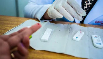 Ambulatório da UEM realiza testes rápidos para HIV e Aids nesta sexta-feira (23) 