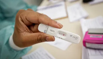 Anvisa aprova uso e comercialização do autoteste no Brasil 