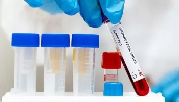 Número de casos de monkeypox se aproxima dos 100 mil em todo o mundo, informa OMS 