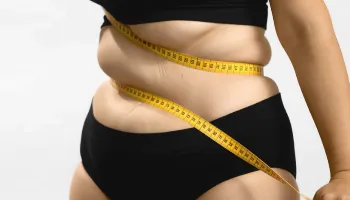 Cinco mitos e verdades sobre a obesidade 