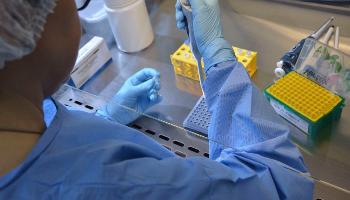 Universidade de Brasília e HUB iniciam teste de vacina contra Covid-19 