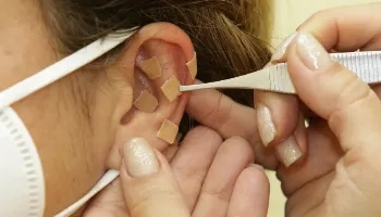 Paraná abre 250 vagas de formação em auriculoterapia para profissionais da saúde 