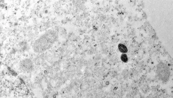 Mais de mil casos de mpox foram confirmados no Brasil em 2024 