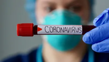 Brasil ultrapassa Itália em número de mortes causadas pela Covid-19 a cada 100 mil habitantes 