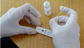 Saiba como funcionam os testes para detectar Covid-19 