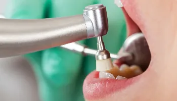 Unicesumar oferece atendimento odontológico gratuito à comunidade 