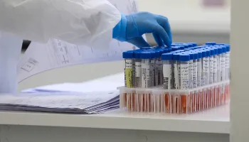 Paraná confirma primeira reinfecção pelo coronavírus 