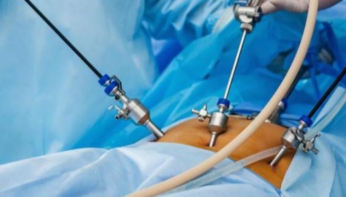 Mais de 68 mil cirurgias bariátricas foram realizadas em 2019 no Brasil