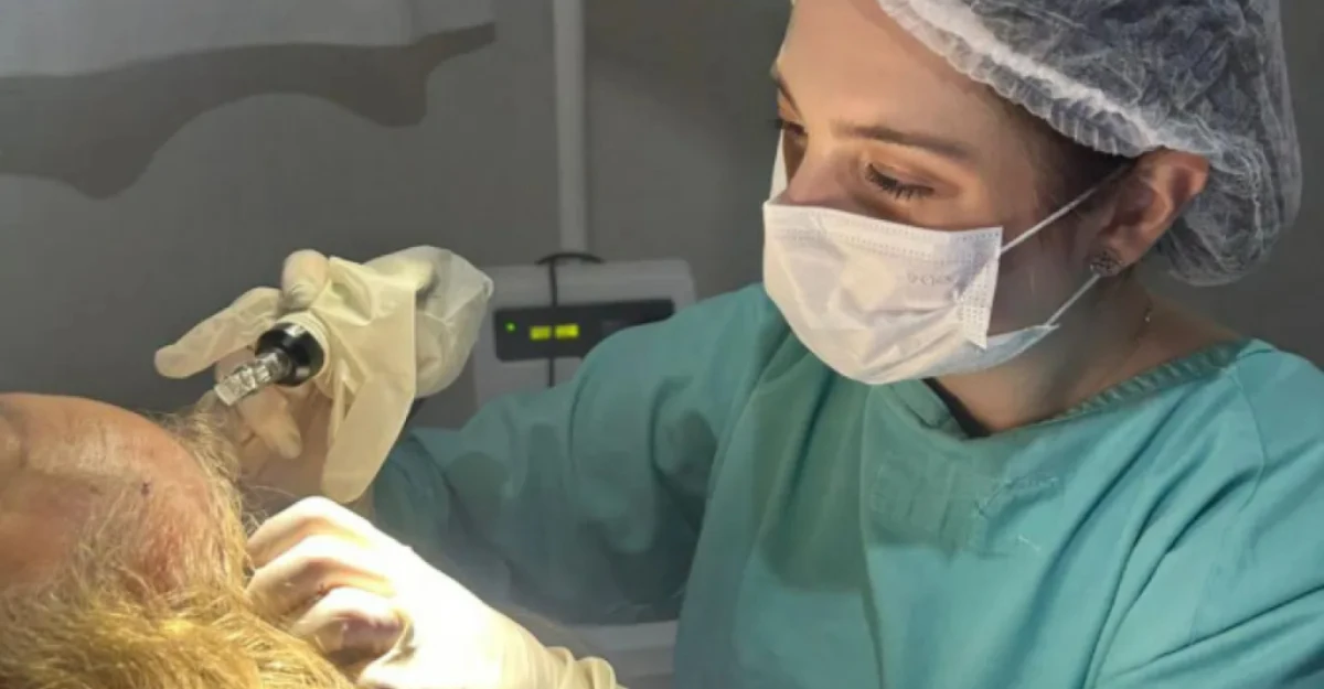 Hospital de Dermatologia Sanitária do Paraná é referência no tratamento da alopecia