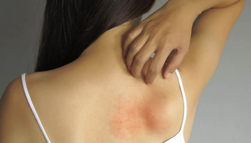Nova Lei da Fibromialgia garante direitos a cerca de 6 milhões de brasileiros