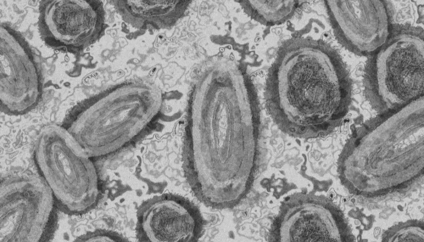 Secretaria de Saúde do Paraná confirma segundo caso de varíola dos macacos