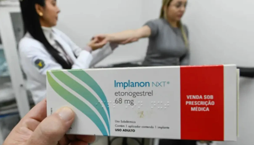 Implante contraceptivo deve ser ofertado por planos de saúde a partir desta segunda (1º) Implante contraceptivo deve ser ofertado por planos de saúde a partir desta segunda (1º)