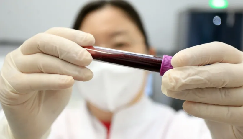A foto mostra uma enfermeira segurando, com as mãos enluvadas, um tubo de ensaio cheio de sangue