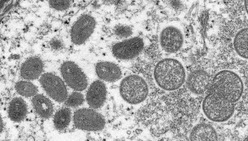 Brasil confirma terceiro caso de varíola dos macacos no país