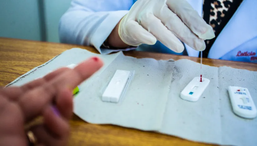Ambulatório da UEM realiza testes rápidos para HIV e Aids nesta sexta-feira (23)