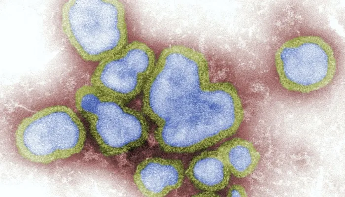 Paraná confirma 134 casos e sete óbitos pela H3N2