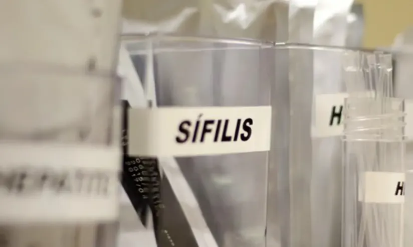 SUS amplia uso de antibiótico para tratamento de ISTs