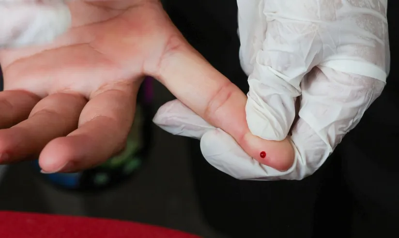 Testes rápidos de dengue começam a ser ofertados pelo SUS
