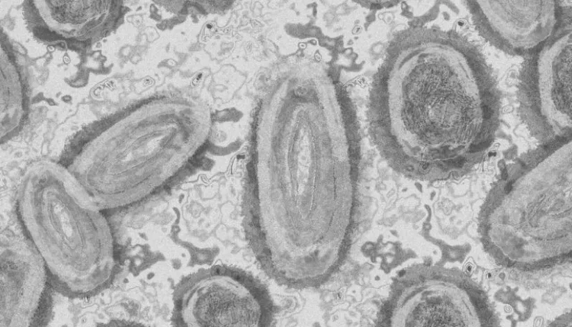 Secretaria de Saúde confirma o primeiro caso de varíola dos macacos em Maringá