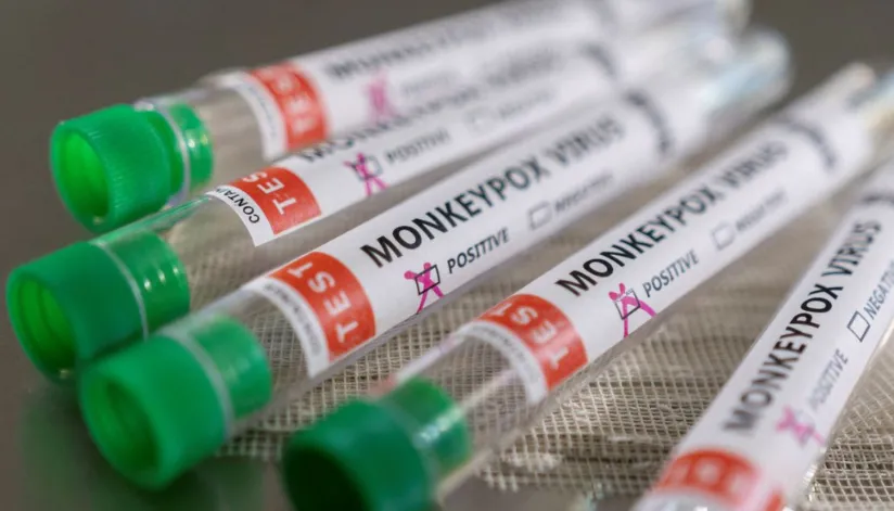 Brasil monitora oito casos suspeitos de varíola dos macacos em seis estados