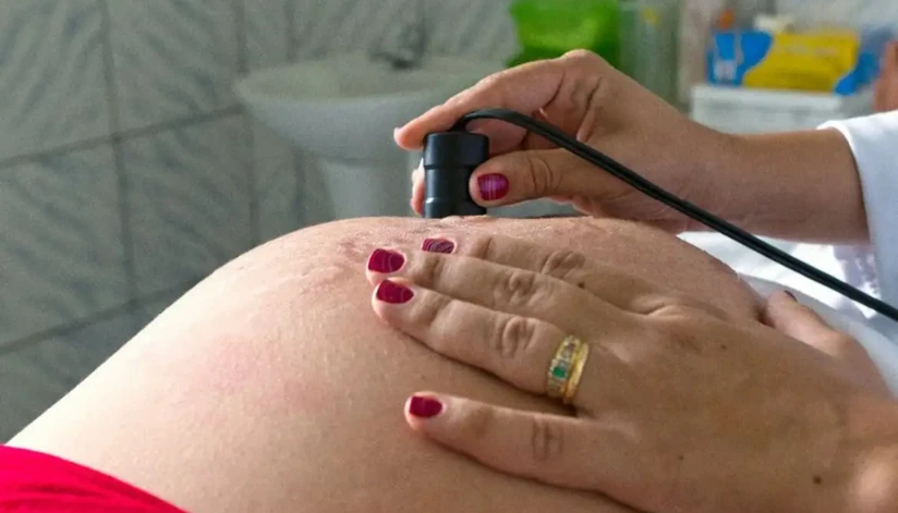 Pré-natal reduz chances de bebê nascer com anomalia, informa estudo da Fiocruz Pré-natal reduz chances de bebê nascer com anomalia, informa estudo da Fiocruz